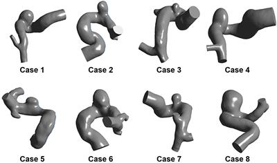 A Dissipation Function–Based Method for Calculating the Energy Loss of Intracranial Aneurysms